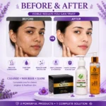 Olifair Night Cream Surefair Cleansing Milk Dreamshine Facewash Combo (50g 100ml 100ml) - Image 6