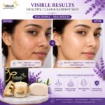 Relook Skin Whitening Combo: Soap & Night Repair Cream - Image 6