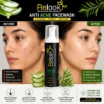 Relook Anti Acne Facewash-100ml - Image 6