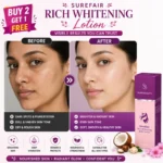 Surefair Rich Whitening Lotion 100g Buy 2 get 1 - Image 6