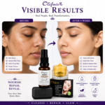 Olifair Night Cream with Day Serum & Olifair Charcoal soap Complexion plus Combo Pack - Image 6