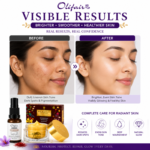 Olifair Night Cream & Day Serum + Free 1 Beautix Fairness Soap - Image 6