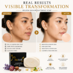 Relook Skin Whitening soap Improved Version 135g - Image 6
